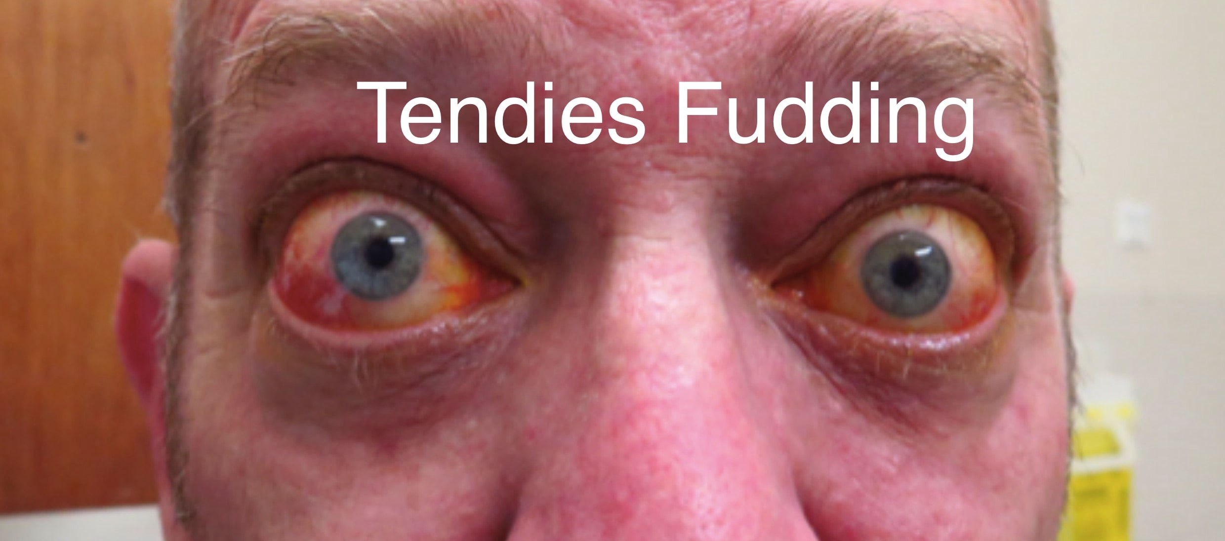 tendiesfud