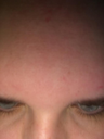 forehead92