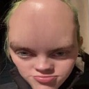forehead73